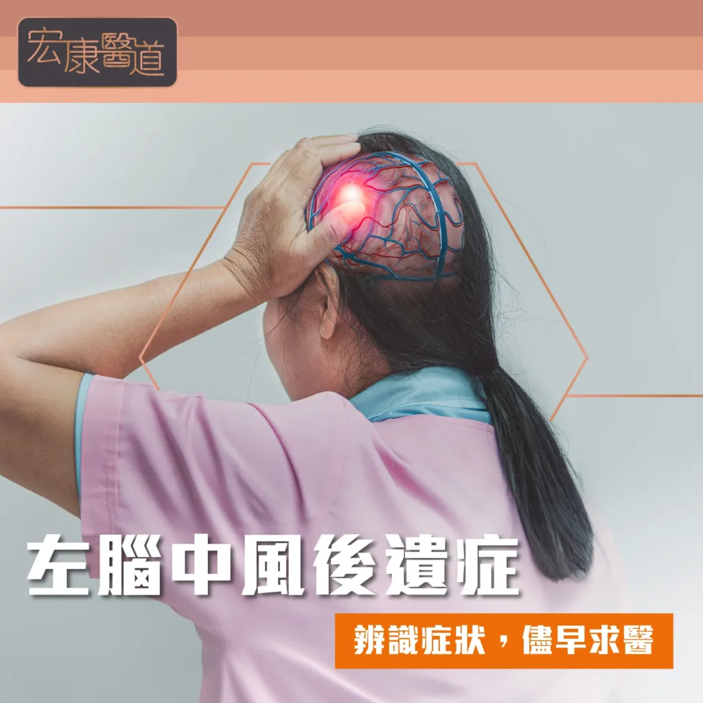 左腦中風後遺症：辨識症狀，儘早求醫