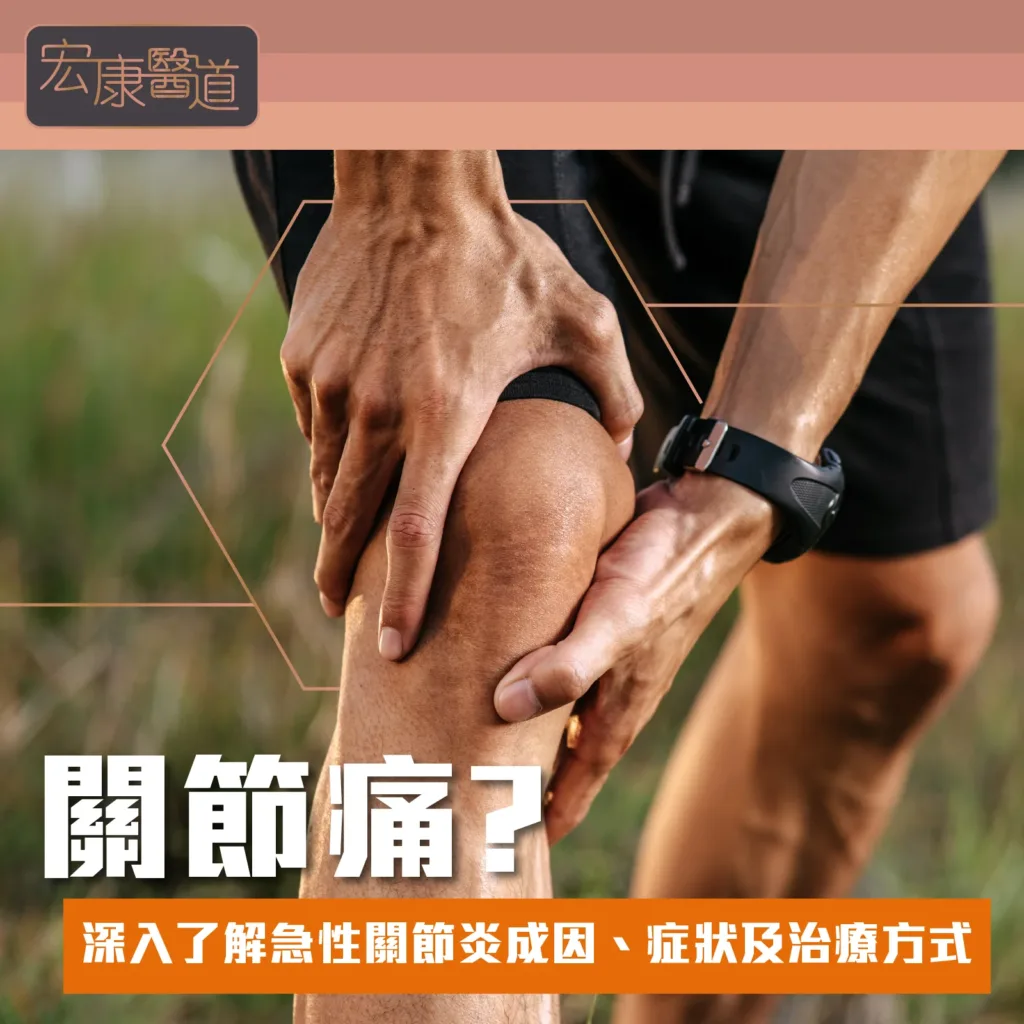關節痛? 深入了解急性關節炎成因、症狀及治療方式