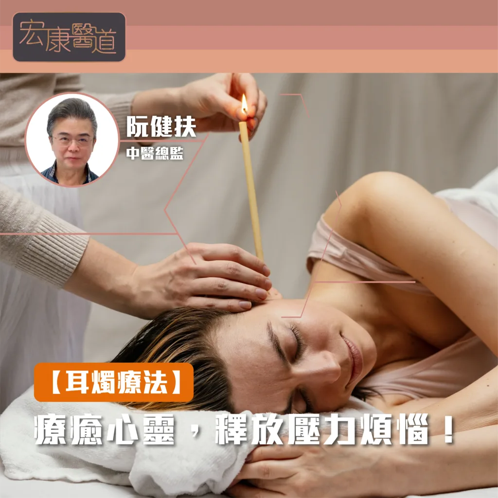 [耳燭療法]療癒心靈，釋放壓力煩惱！