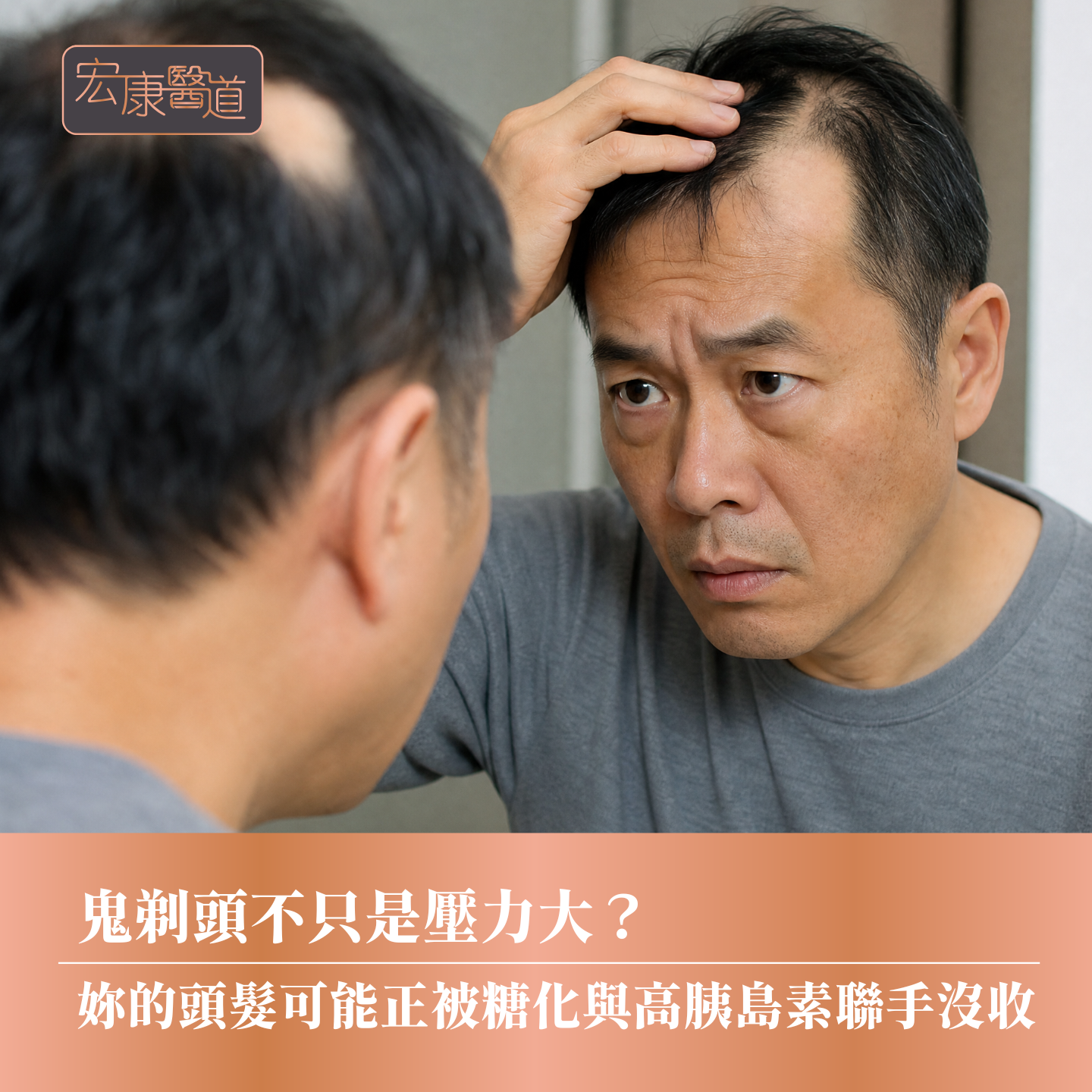 鬼剃頭不只是壓力大? 妳的頭髮可能正被糖化與高胰島素聯手沒收
