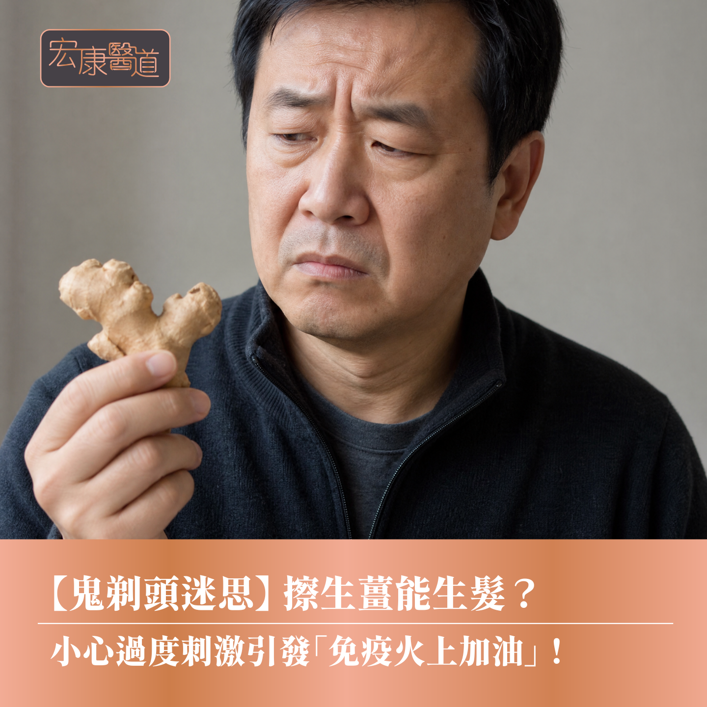 【鬼剃頭迷思】 擦生薑能生髮? 小心過度刺激引發「免疫火上加油」!