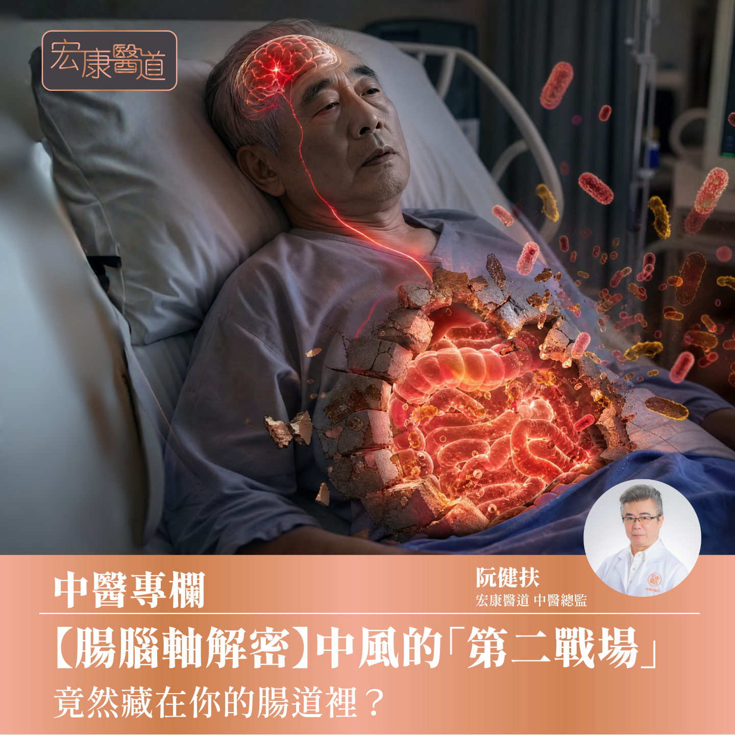 【腸腦軸解密】中風的「第二戰場」 竟然藏在你的腸道裡？