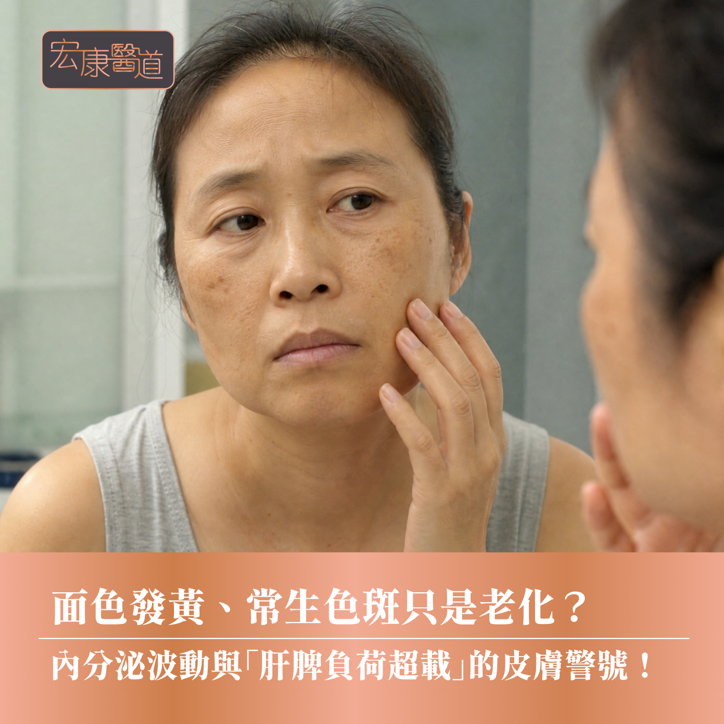 面色發黃、常生色斑只是老化? 內分泌波動與「肝脾負荷超載」的皮膚警號!