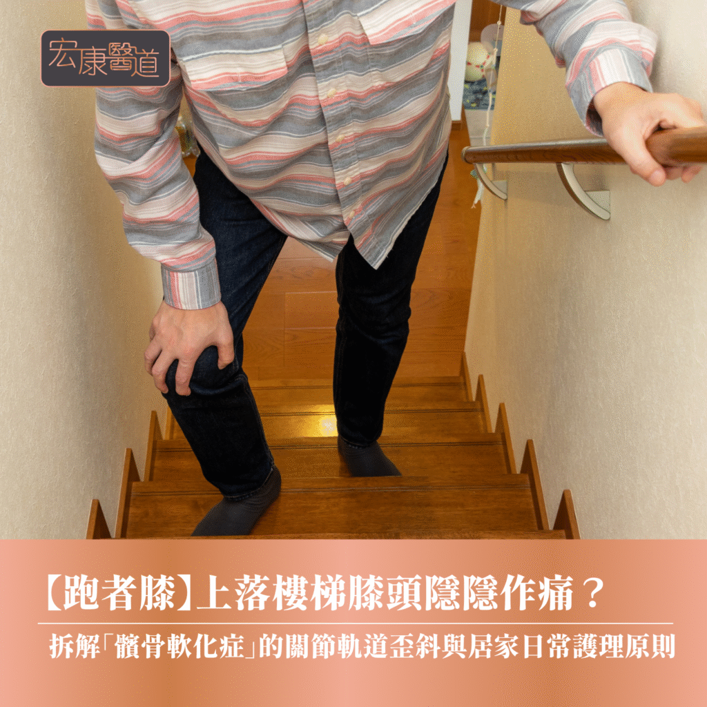 【跑者膝】上落樓梯膝頭隱隱作痛？ 拆解「髕骨軟化症」的關節軌道歪斜與居家日常護理原則