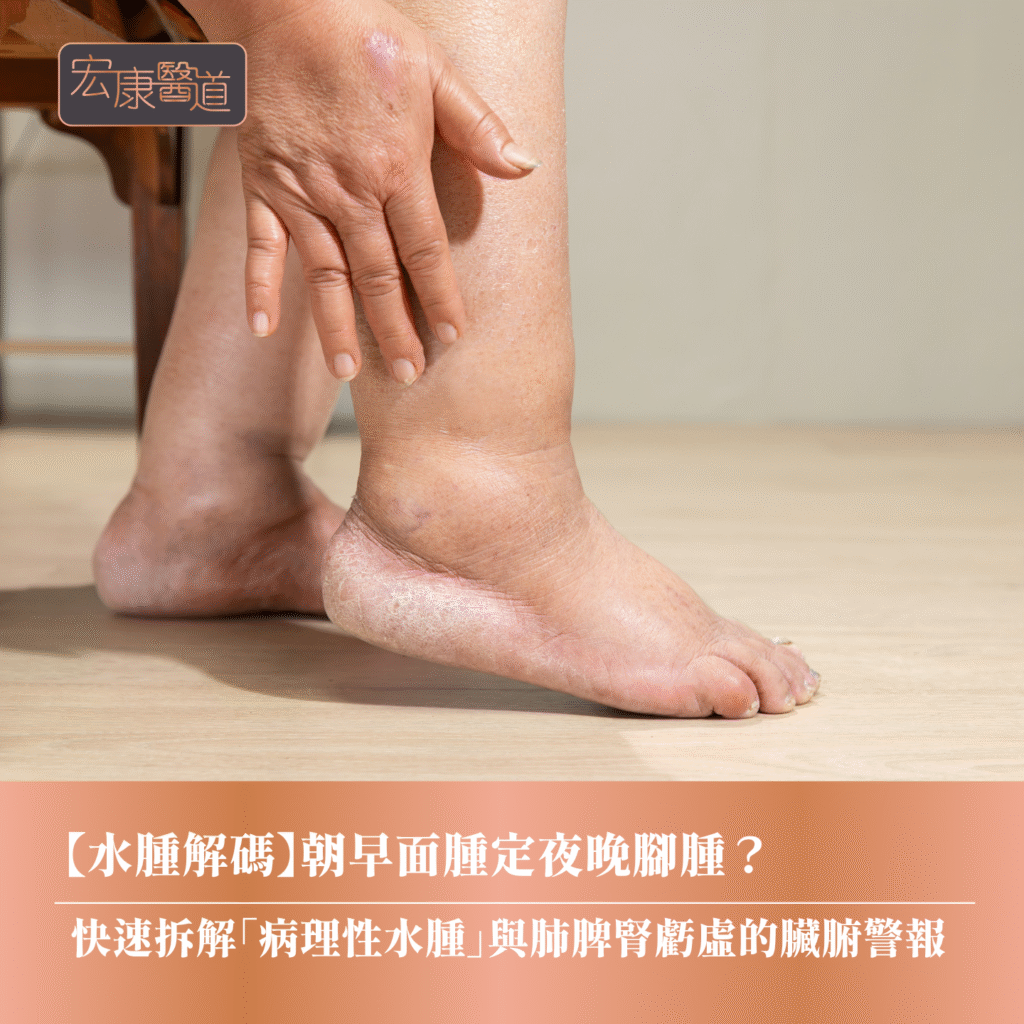 【水腫解碼】朝早面腫定夜晚腳腫？ 快速拆解「病理性水腫」與肺脾腎虧虛的臟腑警報