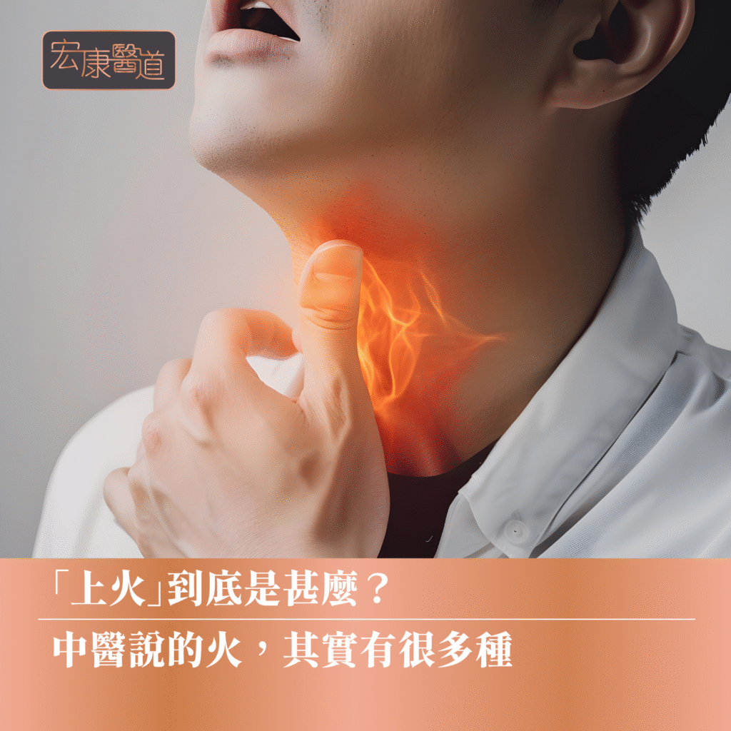 「上火」到底是甚麼？中醫說的火其實有很多種